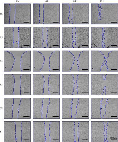 scratch test cell migration protocol|In vitro cell migration quantification method for scratch .